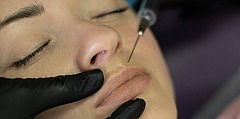 Die Behandlung mit Botox ist ein minimalinvasives Verfahren